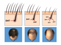 Click image for larger version

Name:	Headstand-hair-growth-e1586786332788.png
Views:	505
Size:	48.3 KB
ID:	73044
